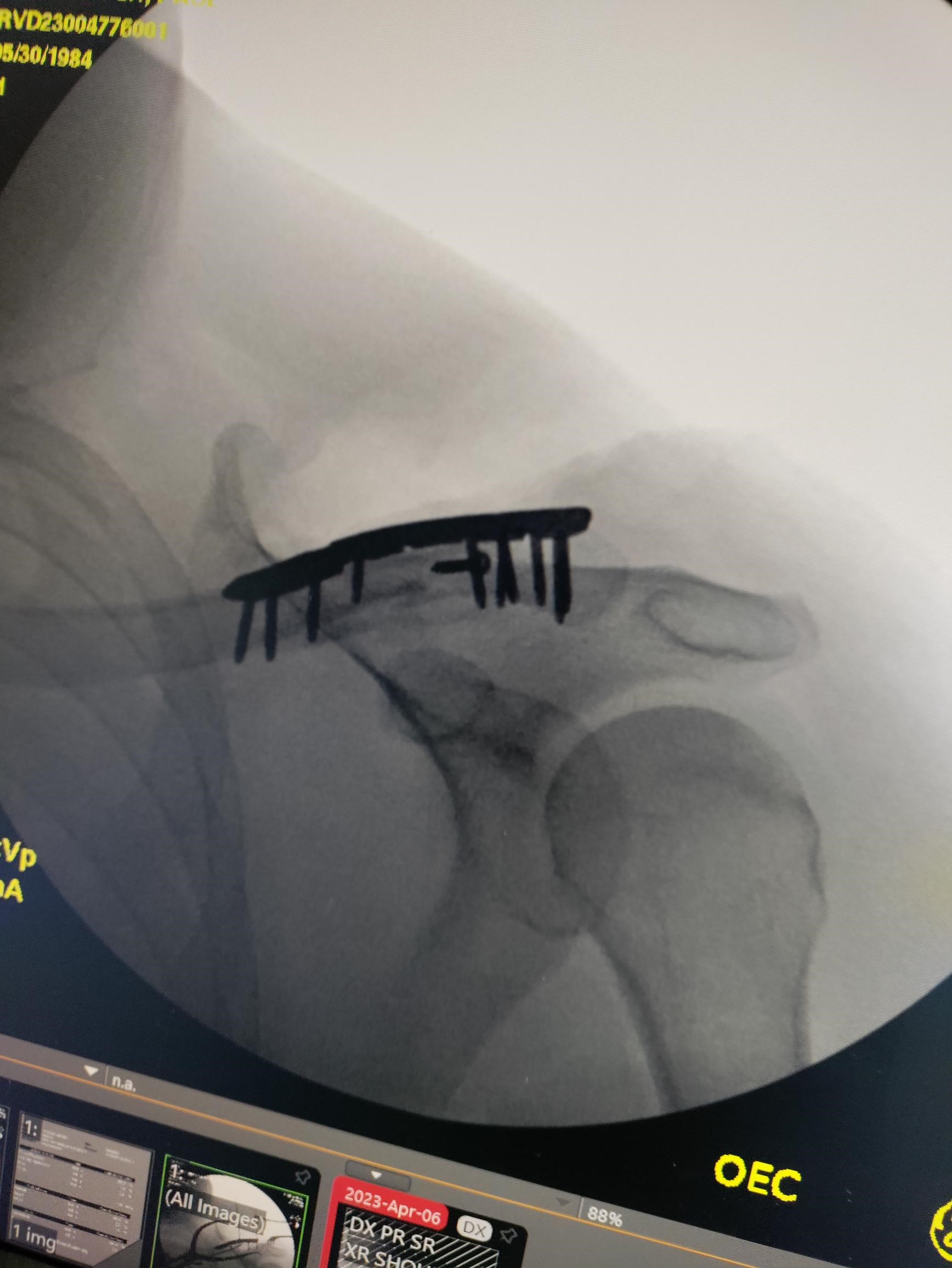 Name:  pD5PWaf.jpg
Views: 600
Size:  275.8 KB