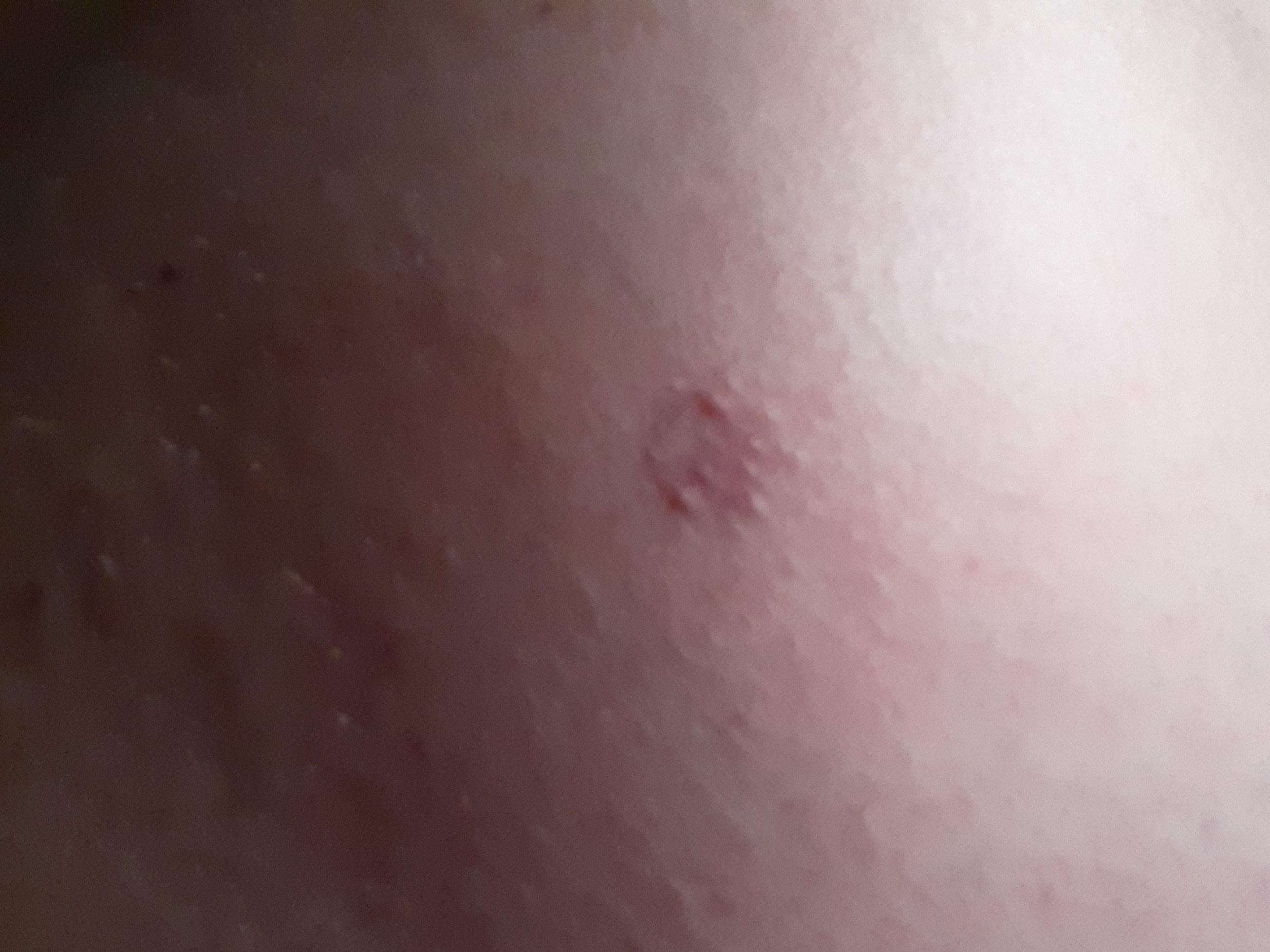 Name:  lAD5fjE.jpg
Views: 150
Size:  302.6 KB