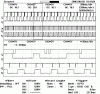 Adaptronic and Megasquirt in a NBB price/setup/performance comparison ?'s-nb_running.gif