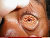 going to korea any advice.-lamprey-disease-34980-700x540.jpg