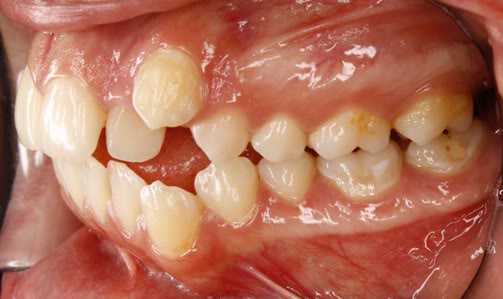 Name:  AR.jpg
Views: 104
Size:  25.4 KB