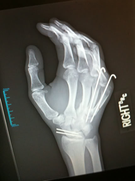 Name:  hand022.jpg
Views: 175
Size:  26.9 KB