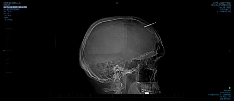 Name:  SCANCEREBRALC-0002.jpg
Views: 110
Size:  18.2 KB