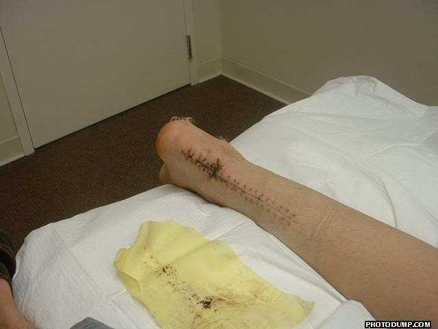 Name:  leg.jpg
Views: 75
Size:  22.8 KB