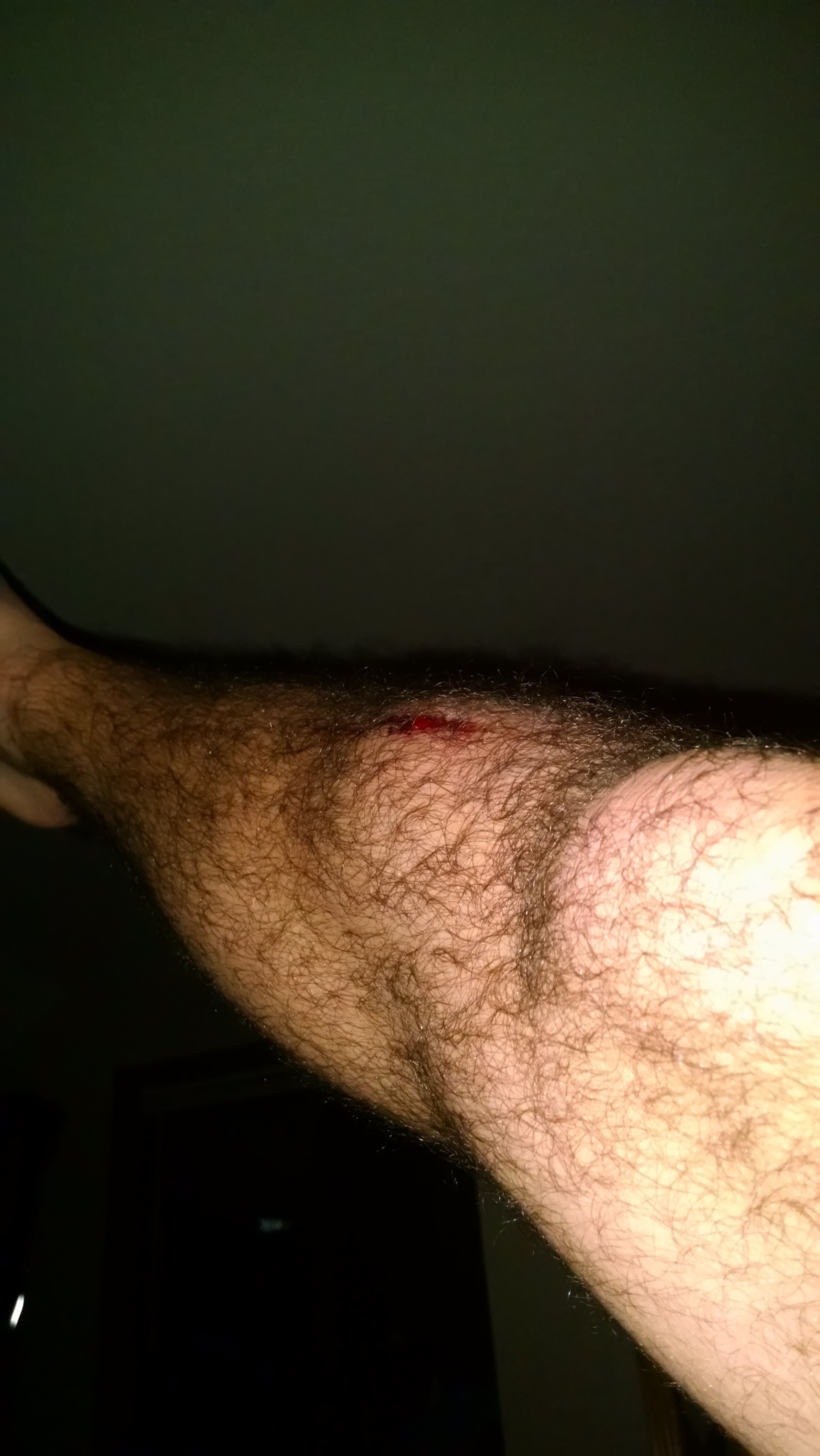 Name:  snWNRA3.jpg
Views: 53
Size:  692.3 KB