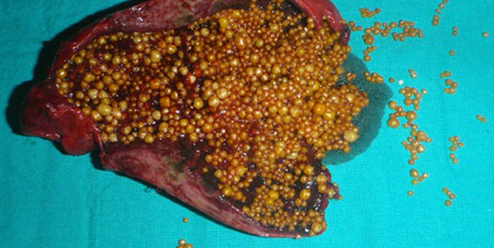 Name:  xx1Iz.png
Views: 45
Size:  250.5 KB